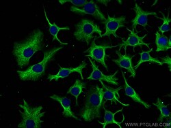 PFKL Mouse Monoclonal Antibody, Proteintech:Antibodies:Primary Antibodies