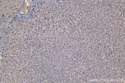 PFKL Mouse Monoclonal Antibody, Proteintech:Antibodies:Primary Antibodies