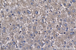 PFKL Mouse Monoclonal Antibody, Proteintech:Antibodies:Primary Antibodies