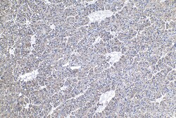 PFKL Mouse Monoclonal Antibody, Proteintech:Antibodies:Primary Antibodies