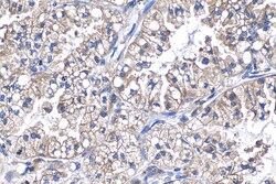 PFKL Mouse Monoclonal Antibody, Proteintech:Antibodies:Primary Antibodies