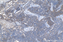 PFKL Mouse Monoclonal Antibody, Proteintech:Antibodies:Primary Antibodies