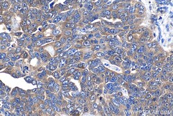 PFKL Mouse Monoclonal Antibody, Proteintech:Antibodies:Primary Antibodies