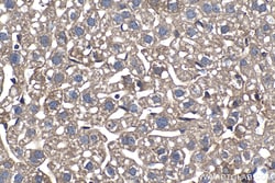 PFKL Mouse Monoclonal Antibody, Proteintech:Antibodies:Primary Antibodies