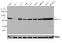 PFKL Mouse Monoclonal Antibody, Proteintech:Antibodies:Primary Antibodies