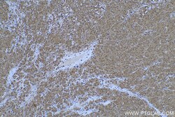 PGK1 Mouse Monoclonal Antibody, Proteintech Unconjugated; 20 &mu;L:Antibodies,