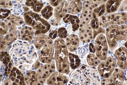 PGK1 Mouse Monoclonal Antibody, Proteintech Unconjugated; 20 &mu;L:Antibodies,