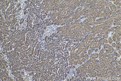 PGK1 Mouse Monoclonal Antibody, Proteintech Unconjugated; 20 &mu;L:Antibodies,