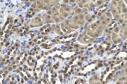 PGK1 Mouse Monoclonal Antibody, Proteintech Unconjugated; 20 &mu;L:Antibodies,
