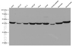 PGK1 Mouse Monoclonal Antibody, Proteintech Unconjugated; 20 &mu;L:Antibodies,