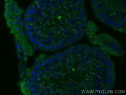 PGK2 Mouse Monoclonal Antibody, Proteintech:Antibodies:Primary Antibodies