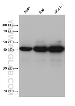 PGK2 Mouse Monoclonal Antibody, Proteintech:Antibodies:Primary Antibodies