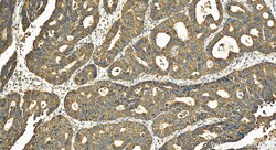 PGT Rabbit Polyclonal Antibody, Proteintech Unconjugated; 20 &mu;L:Antibodies,