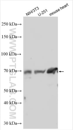 PGT Rabbit Polyclonal Antibody, Proteintech Unconjugated; 20 &mu;L:Antibodies,