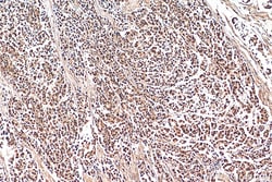 PHF8 Rabbit Polyclonal Antibody, Proteintech 150 &mu;L | Buy Online | Proteintech | Fisher Scientific