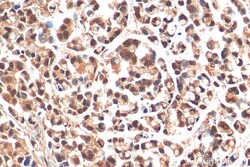 PHF8 Rabbit Polyclonal Antibody, Proteintech 150 &mu;L | Buy Online | Proteintech | Fisher Scientific