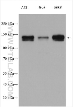 PHF8 Rabbit Polyclonal Antibody, Proteintech 150 &mu;L | Buy Online | Proteintech | Fisher Scientific