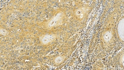 PHLDB2 Rabbit Polyclonal Antibody, Proteintech:Antibodies:Primary Antibodies