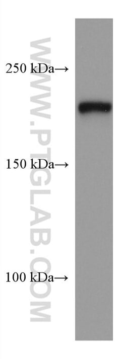 PHLPP Mouse Monoclonal Antibody, Proteintech:Antibodies:Primary Antibodies