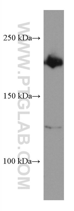PHLPP Mouse Monoclonal Antibody, Proteintech:Antibodies:Primary Antibodies
