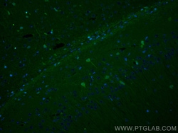 CoraLite Plus 488-conjugated PINK1 Rabbit Polyclonal Antibody, Proteintech