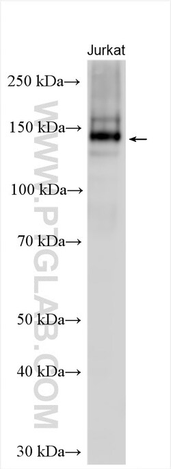 PJA2 Rabbit Polyclonal Antibody, Proteintech:Antibodies:Primary Antibodies