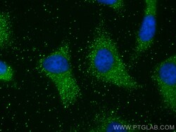 PKIA Rabbit Polyclonal Antibody, Proteintech Unconjugated; 20 &mu;L:Antibodies,