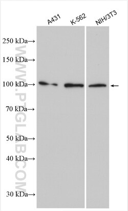 PLA2G4E Rabbit Polyclonal Antibody, Proteintech:Antibodies:Primary Antibodies