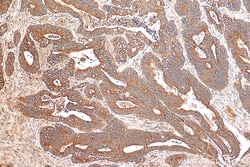 PLK4 Rabbit Polyclonal Antibody, Proteintech Unconjugated; 150 &mu;L:Antibodies,