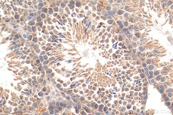 PLK4 Rabbit Polyclonal Antibody, Proteintech Unconjugated; 150 &mu;L:Antibodies,