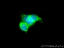 PLOD1 Rabbit Polyclonal Antibody, Proteintech Unconjugated; 20 &mu;L:Antibodies,