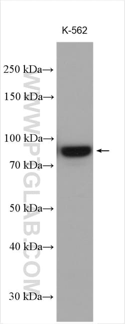 PLOD1 Rabbit Polyclonal Antibody, Proteintech Unconjugated; 20 &mu;L:Antibodies,