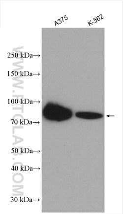 PLOD1 Rabbit Polyclonal Antibody, Proteintech Unconjugated; 20 &mu;L:Antibodies,