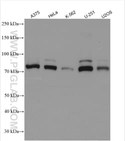 PLOD1 Rabbit Polyclonal Antibody, Proteintech Unconjugated; 20 &mu;L:Antibodies,