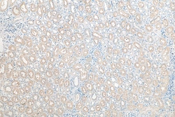 PLS1 Rabbit Polyclonal Antibody, Proteintech Unconjugated; 150 &mu;L:Antibodies,