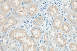 PLS1 Rabbit Polyclonal Antibody, Proteintech Unconjugated; 150 &mu;L:Antibodies,