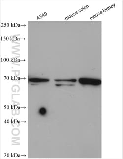 PLS1 Rabbit Polyclonal Antibody, Proteintech Unconjugated; 150 &mu;L:Antibodies,