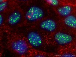 PMS1 Mouse Monoclonal Antibody, Proteintech Unconjugated; 20 &mu;L:Antibodies,