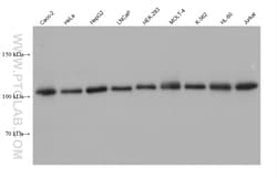 PMS1 Mouse Monoclonal Antibody, Proteintech Unconjugated; 20 &mu;L:Antibodies,