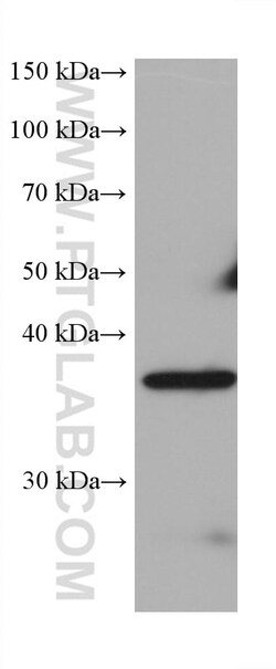 PNMA1 Mouse Monoclonal Antibody, Proteintech:Antibodies:Primary Antibodies
