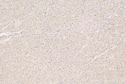 PNPLA3 Rabbit Polyclonal Antibody, Proteintech:Antibodies:Primary Antibodies