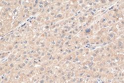 PNPLA3 Rabbit Polyclonal Antibody, Proteintech:Antibodies:Primary Antibodies