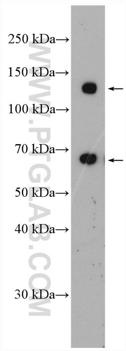 PNPLA3 Rabbit Polyclonal Antibody, Proteintech:Antibodies:Primary Antibodies