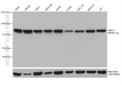 PNPT1 Mouse Monoclonal Antibody, Proteintech:Antibodies:Primary Antibodies