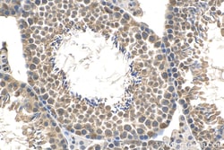 POGZ Rabbit Polyclonal Antibody, Proteintech Unconjugated; 150 &mu;L:Antibodies,