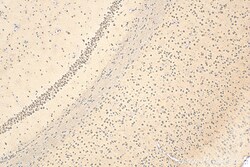 POGZ Rabbit Polyclonal Antibody, Proteintech Unconjugated; 150 &mu;L:Antibodies,