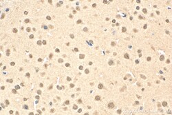 POGZ Rabbit Polyclonal Antibody, Proteintech Unconjugated; 150 &mu;L:Antibodies,