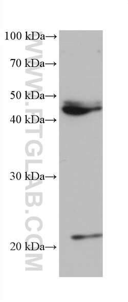 POLR3D Mouse Monoclonal Antibody, Proteintech:Antibodies:Primary Antibodies