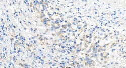 POLRMT Rabbit Polyclonal Antibody, Proteintech Unconjugated; 20 &mu;L:Antibodies,
