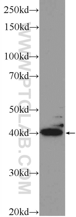 POU4F2 Rabbit Polyclonal Antibody, Proteintech Unconjugated; 20 &mu;L:Antibodies,